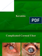 Keratitis III