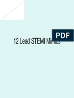 12 Lead STEMI Mimics