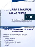 Tumores Benignos de Mama