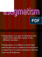 Astigmatism 2