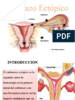 EMBARAZO ECTOPICOppt