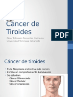 Cáncer de Tiroides