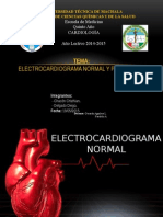 Electrocardigrama