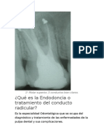 1º Molar Superior