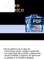 Cancer Gástrico