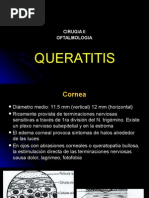 Queratitis