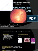 Toxoplasmosis Ocular