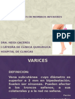 Varices