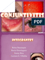 Conjuntivitis