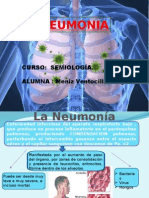 Neumonia