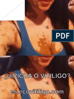 ¿Jiricua o Vitiligo? 