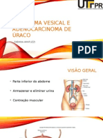 Leiomioma e Adenocarcinoma de Úraco