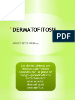 DERMATOFITOSIS