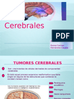 Seminario de Tumores Cerebrales 