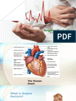 Angina Pectoris