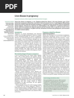 Jaundice in Pregnancy