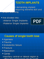 Single Tooth Implants