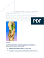 Litiasis Renal