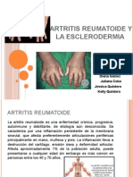 Artritis Reumatoide y La Esclerodermia