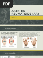 Artritis Reumatoide Ar