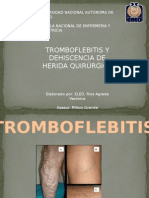 Tromboflebitis