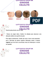 Lipodistrofia Ginoide Equilibra