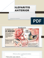 Blefaritis Anterior