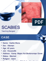 Scabies: Teaching Bangsal