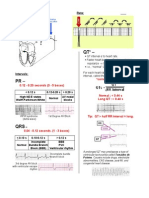 A Simplified ECG Guide