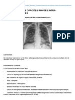 Le Diagnostic Des Opacites Rondes Intra-Parenchymateuses