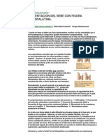 Alimentacion Del Bebe Con Fisura Labiopalatina. - Fonoactiva