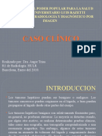 CASO CLINICO Hepatocelular