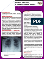 Chilaiditi Syndrome - A Benign Air Under Diaphragm