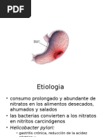 Etiología de Cáncer Gástrico o Cáncer de Estómago