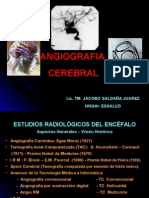 Angiografia Cerebral