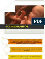 Polihidramnios Oligohidramnios