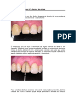 Caso Clínico - Clareamento em Dente Não Vital