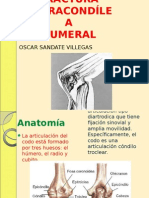 Fractura Supracondílea