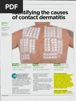 Identifying The Cause of Contact Dermatitis