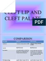 Cleft Lip and Cleft Palate