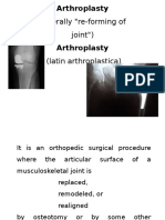 (Literally "Re-Forming of Joint") : Arthroplasty