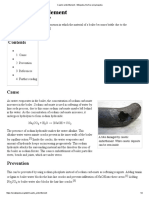 Caustic Embrittlement - Wikipedia, The Free Encyclopedia