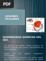 Lesiones Oculares