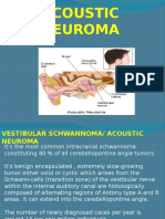 Acoustic Neuroma