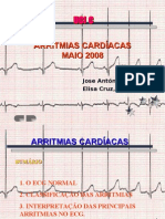 Arritmias II