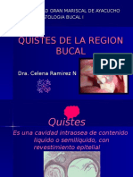 Quistes de La Region Bucal