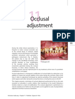 Ajuste Oclusal de OcclusionMadeEasy Preview