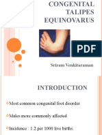 Congenital Talipes Equinovarus Final