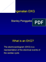 Ekg