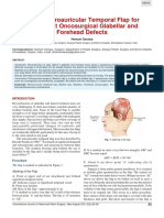 Use of Retroauricular Temporal Flap For Large Post Oncosurgical Glabellar and Forehead Defects